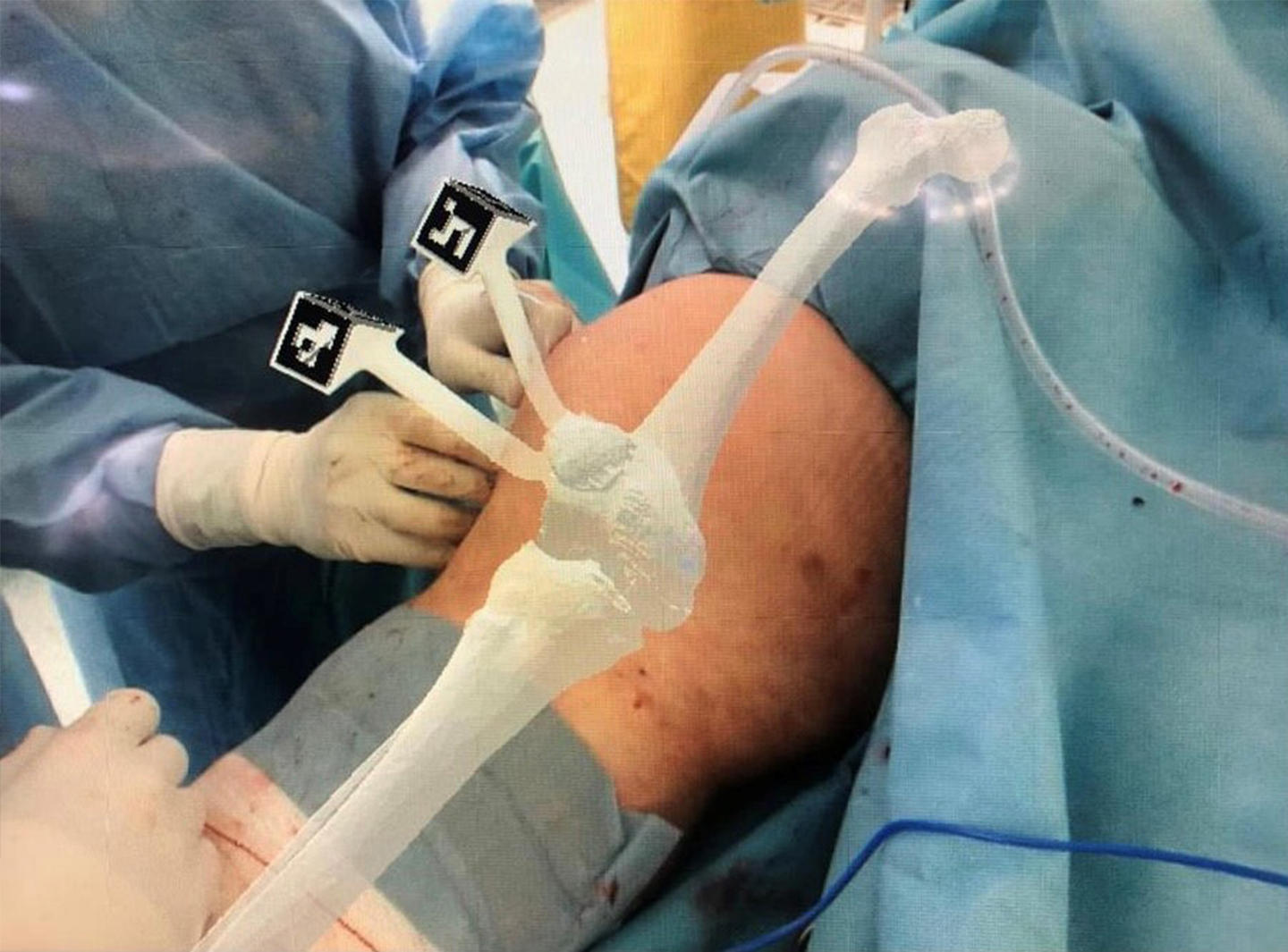 Así ha transformado la tecnología la asistencia sanitaria en los mejores hospitales